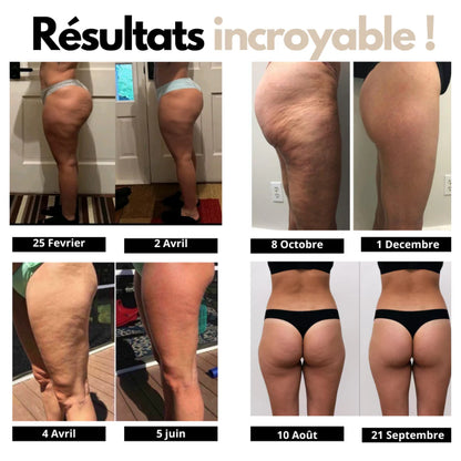 Legging Skin™ 3D Anti-Cellulite